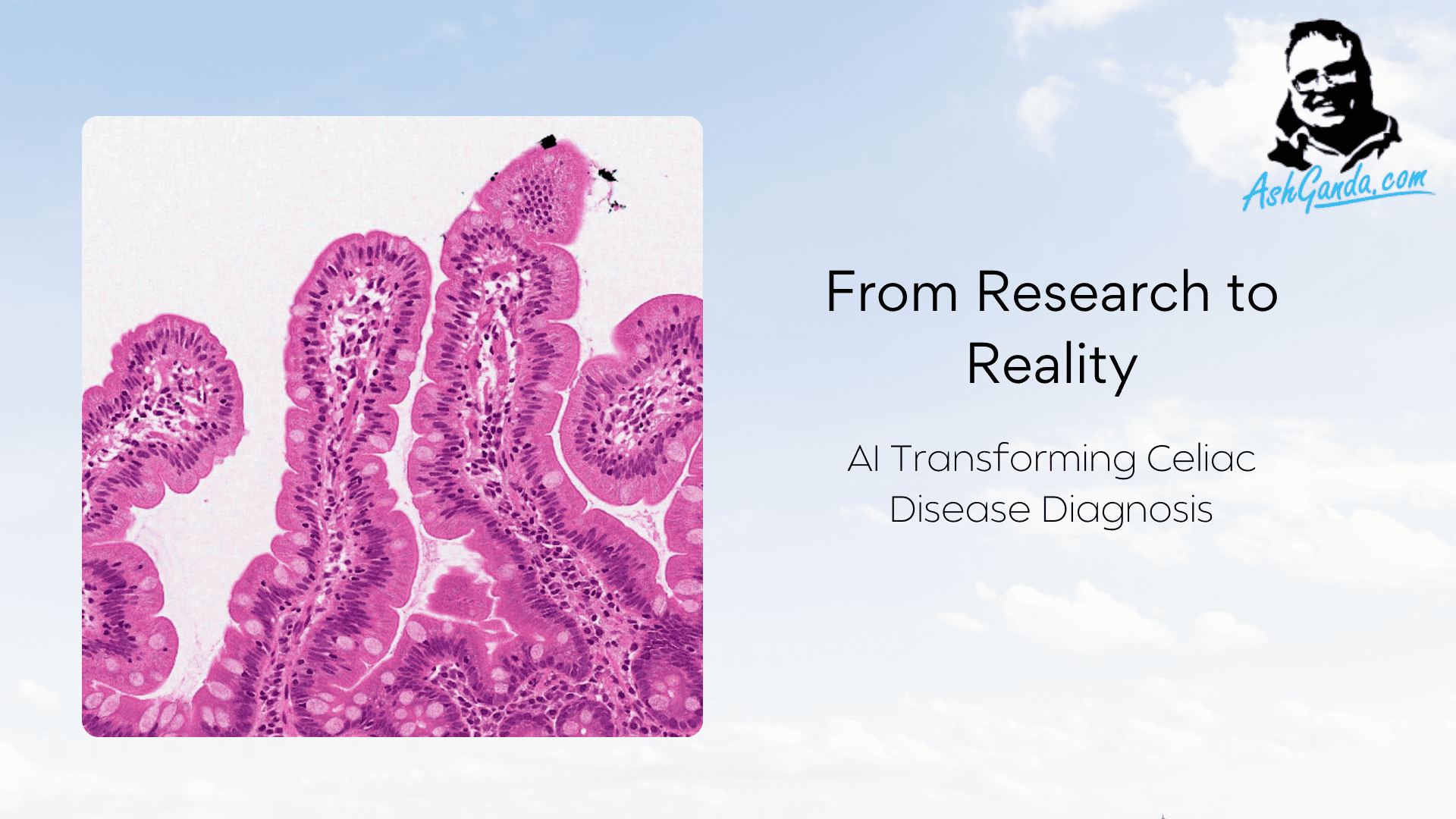 AI for Celiac Disease Diagnosis: From Research to Reality
